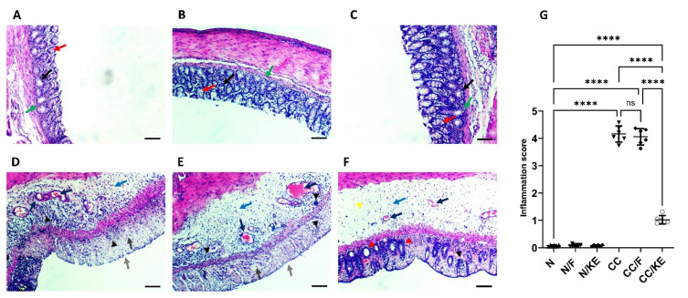 Ketone Ester Superiority in Chronic Colitis