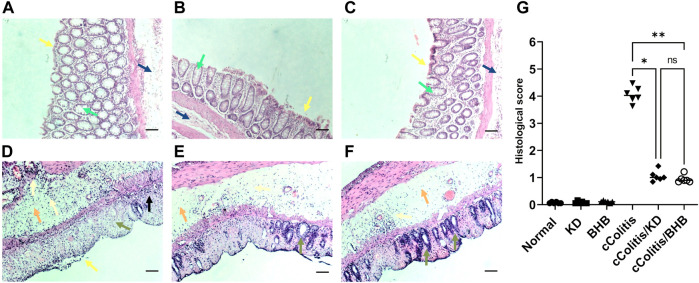 BHB-Driven NLRP3 Inhibition in Colitis